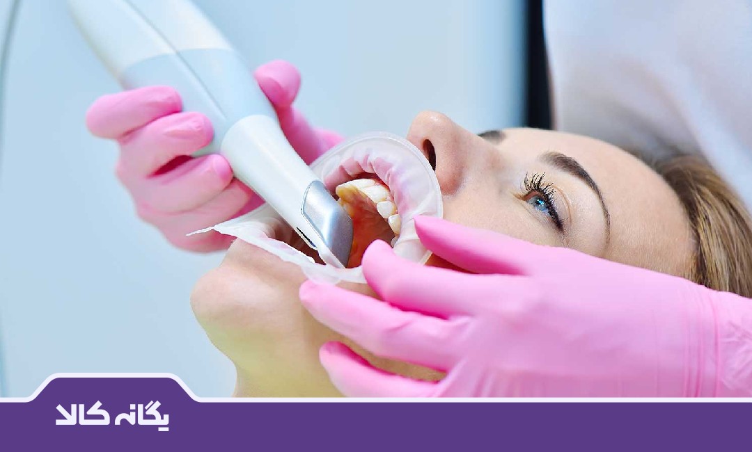 نحوه عملکرد اسکنر داخل دهانی